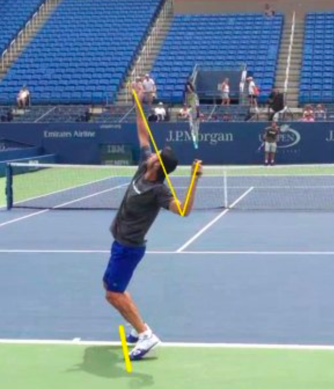 Tennis Serve Analysis Using Edit Lines